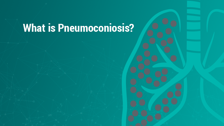 Pneumoconiosis adalah kondisi paru-paru yang disebabkan oleh menghirup partikel debu mineral, biasanya saat bekerja di industri yang berhubungan dengan mineral berisiko tinggi